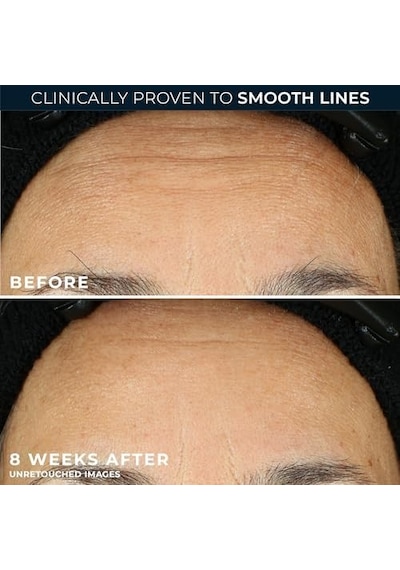 Roc Retinol Correxion Smoothing Kırışıklık Karşıtı Kapsül Serum 10 Adet