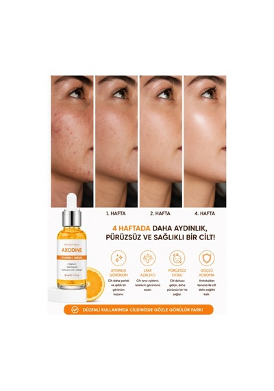 Axodine C Vitamini Aydınlatıcı ve Ton Eşitleyici Bakım Serumu 30 ML