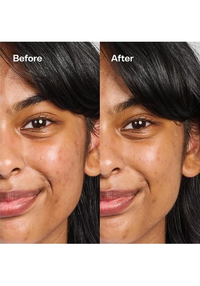 Bubble Skincare Under Cover Leke Karşıtı Renk Düzenleyici Balm 15ml
