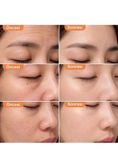 Touchbeauty Tb1712 Çok Fonksiyonlu, 6 Kademeli, Yüz Ve Göz Çevresi Bakım Cihazı