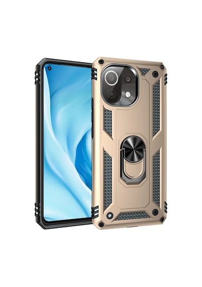 Xiaomi Mi 11 Lite Uyumlu Kılıf Sofya Yüzüklü Silikon Kapak - Gold