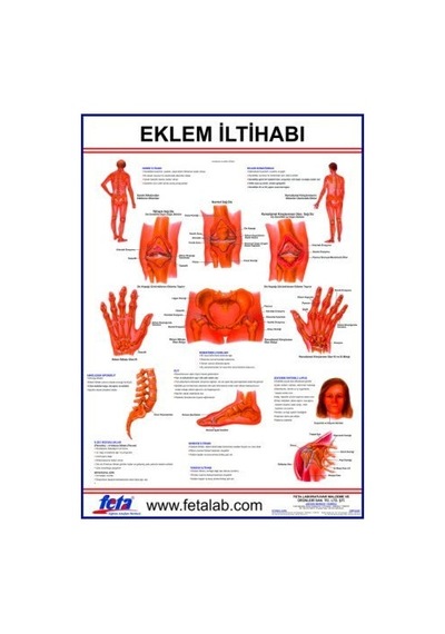 Eklem Iltihabı Levhası