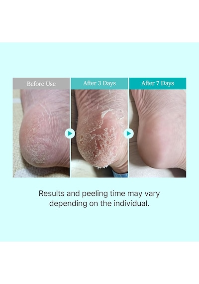 Ariul Smooth & Pure Exfoliating Foot Peeling Mask 2 Pairs - Yenileyici & Arındırıcı Ayak Peeling Maskesi 2 Çift