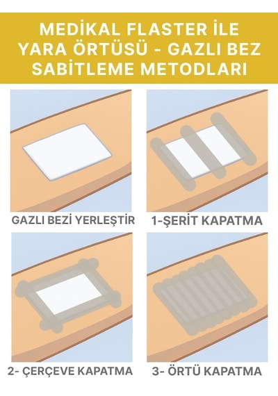 Alban Medikal Sabitleme Flasteri İpek Bant 10 CM x 5 M