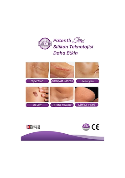 Advancis Medical UK Siltape Soft Silikon Yara İzi Dikiş İzi Sezaryen Yanık Estetik Bant 2 CM x 3 M