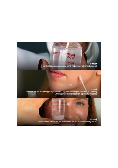 Akne Karşıtı 30 Ml Losyon, Sivilce Temizleyici