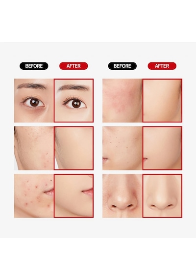 Merythod Dual Concealer 01 Pure Ivory - Çift Uçlu Kapatıcı Stick Ve Likit