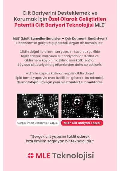 Bebeklere&yenidoğanlara Özel Konak Karşıtı Saç Derisi Losyonu Atopalm Newborn Scalp Lotion