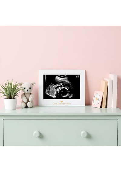 Lexroo Sonogram Resim Çerçevesi Hamilelik Hatırası