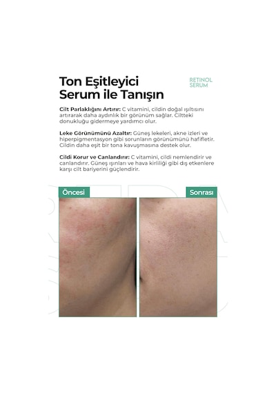 Ton Eşitleyici,leke Karşıtı Aydınlatıcı Retinol Serum 50ml
