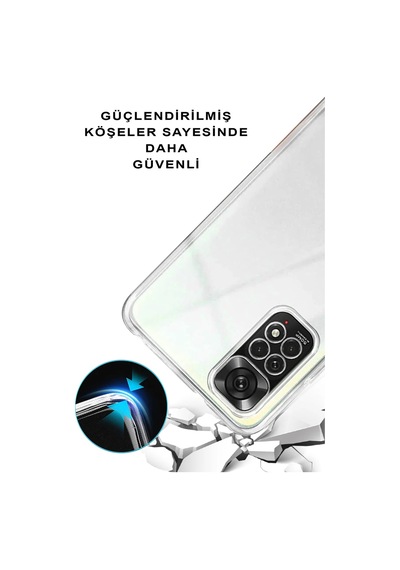 Xiaomi Poco X3 Kamera Korumalı Tıpalı Kapak Renk Cümbüşü Tasarımlı Şeffaf Kılıf