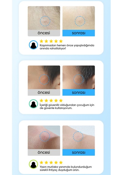 Yatıştırıcı Ve Önleyici Mikro İğneli Bant Soothing Care Microcone Patch 12 Li