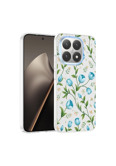 Xiaomi 15t Kılıf Çiçek Ve Fiyonk Desenli Kamera Yükseltili Celikaksesuar Premium Mavi