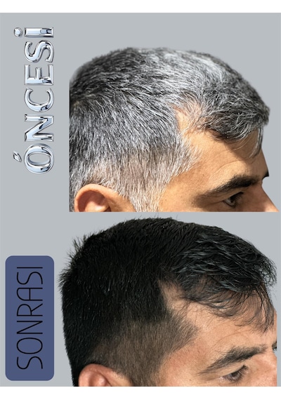 Paxe Black Hair Shampoo Beyaz Saç Kapatıcı 10lu Paket Tüm Saç Tipleri