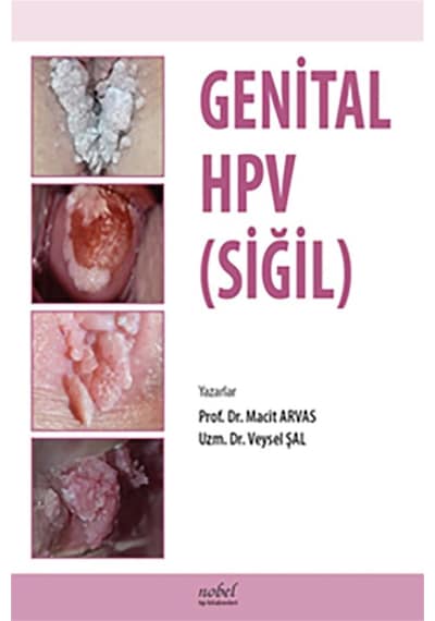 Genital HPV (Siğil) - Macit Arvas -  Veysel Şal - Nobel Tıp Kitabevleri