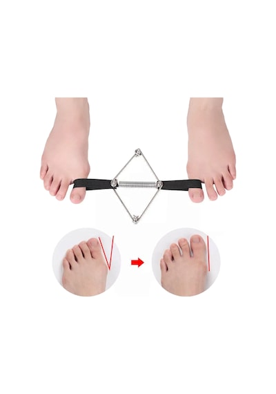 Akestoria Med Halluks Valgus Metal Egzersiz Bandı Baş Parmak Arası Metal Yay Fc-043 Standart