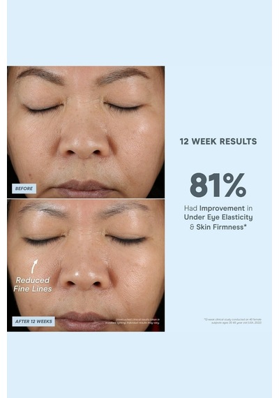 Nuface Super Vita- Niasinamidli C Vitamini Yüz Serumu 30 Ml Serumlar