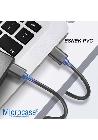 Microcase Usb A To Usb A İki Ucu Erkek Çift Taraflı Usb 2.0 Kablo 30 Cm Al4773 Siyah