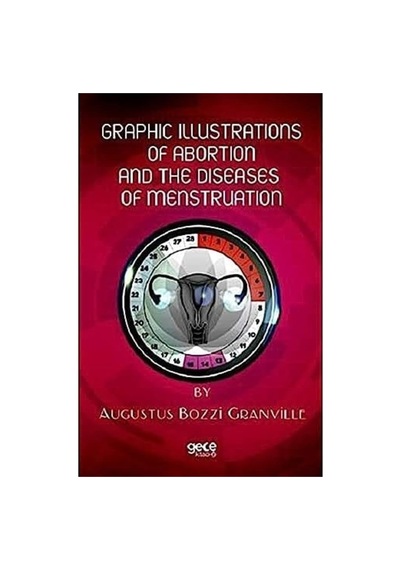 Graphic Illustrations Of Abortion And The Diseases Of Menstruation