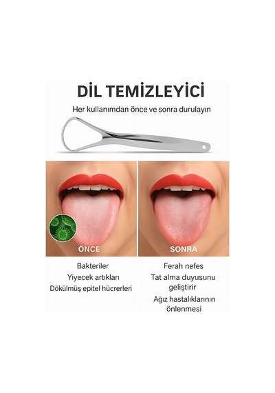 Mucit Home Dil Temizleyici Gümüş Ağız Bakım Dil Plak Temizleme Dil Sıyırıcı