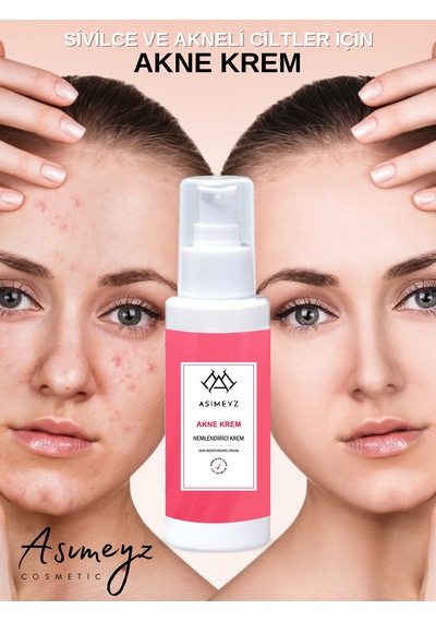 Asimeyz Sivilce Karşıtı Akne Kremi 100 ML