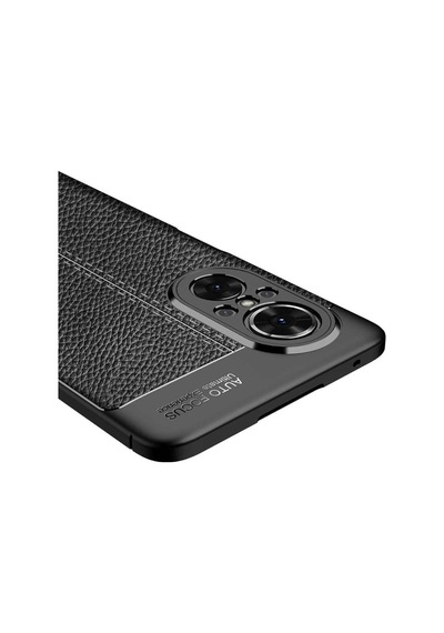 Huawei Nova 9 Se Kılıf Zore Niss Deri Desenli Silikon Kılıf