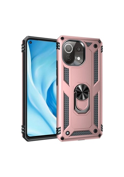 Xiaomi Mi 11 Lite Kılıf Sofya Yüzüklü Silikon Kapak