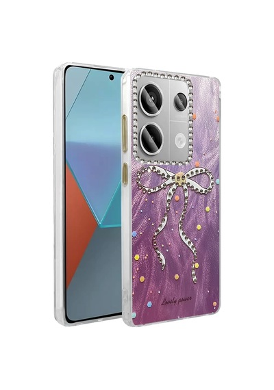 Newface - 272 - Xiaomi Redmi Note 13 Pro 4g Kılıf Blade Aynalı Desenli Kapak - - Csmo-tex - Desen 1 Diğer