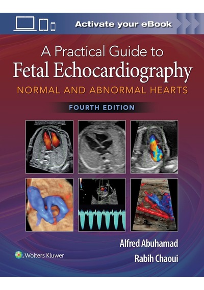 A Practical Guide To Fetal Echocardiography: Normal And Abnormal Hearts