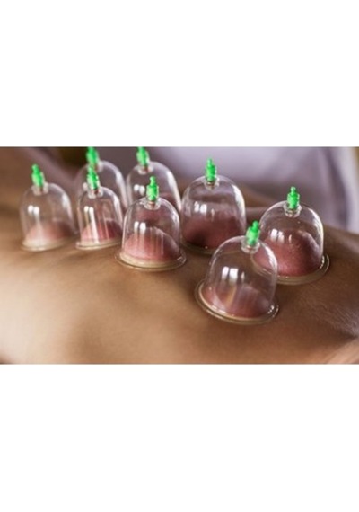 Hacamat Kupası 10 Adet 3Cm 1.Kalite + Hacamat Pompası