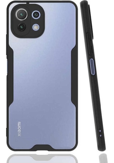 Xiaomi Mi 11 Lite Kilif Kamera Korumali Colorful Kapak 502111114