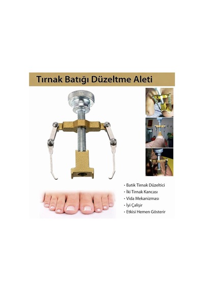Coverzone Batık Tırnak Düzeltme Aleti - Vida Mekanizması Ve İki Tırnak Kancasıyla Etkili Batık Tırnak Tedavisi