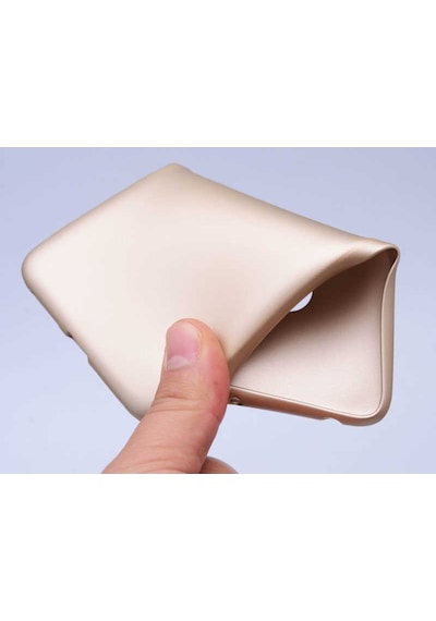 Xiaomi Mi 8 Kilif Soft Mat Premier Case 394917684