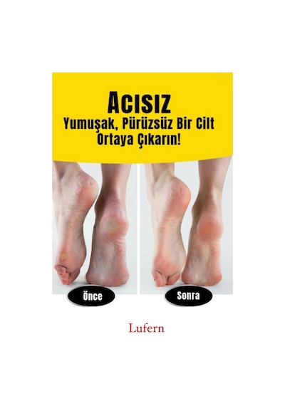 Topuk Nasır Temizleme Bakımı Bakım Törpüsü Pedegg Kutulu Rendesi Yumuşak Pürüzsüz Paslanmaz Çelik