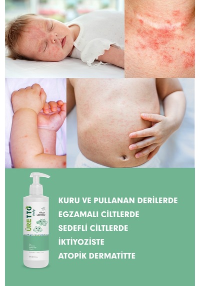Üretto Baby Vüct Losyonu 200 Ml