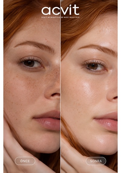 Işıltı 18 Bisabolol Aydınlatıcı Serum 30 ML