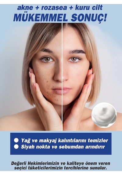 Tto Çay Ağacı Özlü Aplikatörlü Yüz Temizleme Köpüğü 200 ML