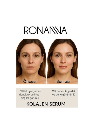 Ronanna Kolajen Serum - Botox Etkili, Allantoin, Salisilik Asit, Hyalüronik Asit - 30ml