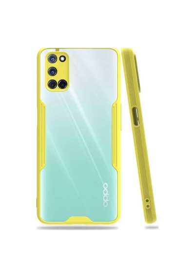 Oppo A72 Tam Korumali Renkli Kenarli Parfe Kilif 521955708