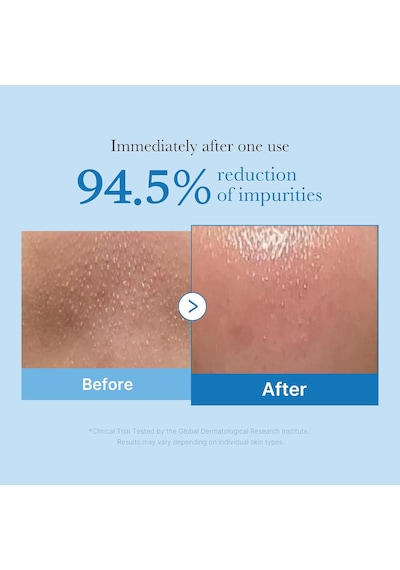 Medicube Zero Pore Blackhead Deep Cleansing Oil 200 ML
