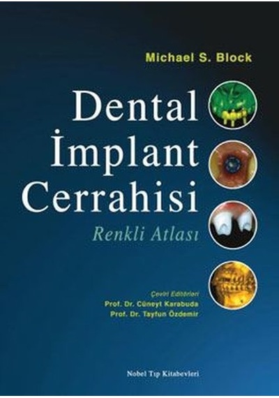 Dental İmplant Cerrahisi Renkli Atlası- Nobel Tıp Kitabevleri
