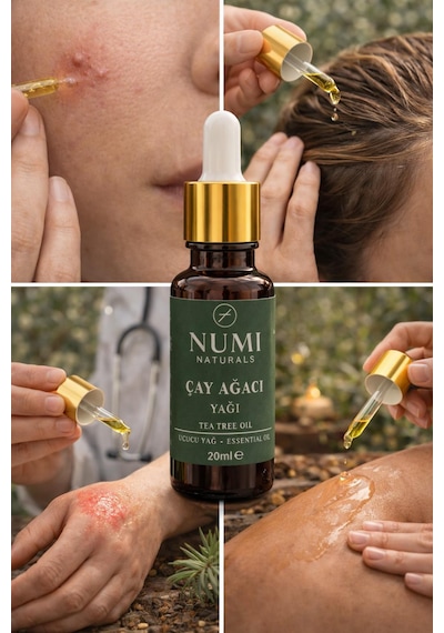 Çay Ağacı Yağı 20 Ml Saf Tea Tree Oil Uçucu Yağ, Cilt Ve Aromaterapi Yağı