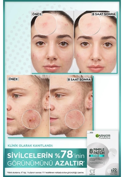 Pimple Patch Cilt Kusurları Görünümü Karşıtı Bant & Salisilik Sivilce İzi Karşıtı Peeling Tonik pktsivilcebantonik-10710