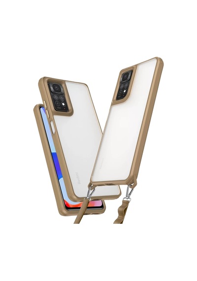 Newface Xiaomi Redmi Note 11 Pro Kılıf Penta Silikon Kılıf - Çöl Titanyum