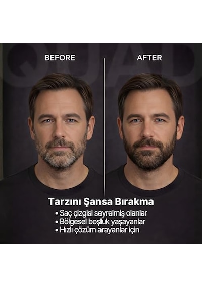 Saç Kapatıcı Pudra, Kahverengi, Unisex Saç Ve Sakal Dolgunlaştırıcı, Doğal Görünüm, 10gr