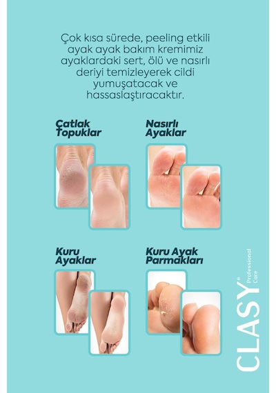 Ayak Ve Topuk Çatlak Kremi, Ayak Bakımı, Ayak Kokusu Ve Topuk 100ml