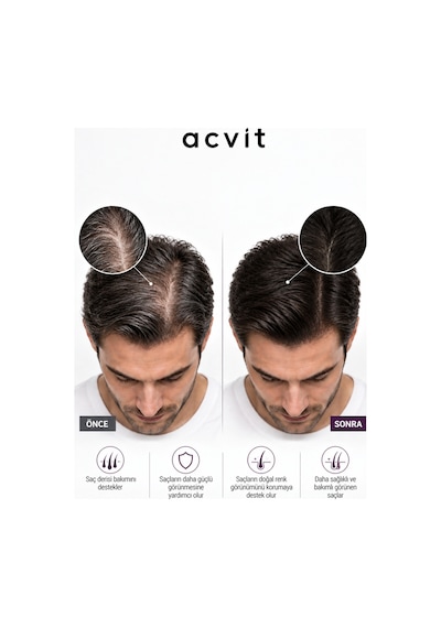 Acvit Anti Grey Hair Growth Serum 50 ML