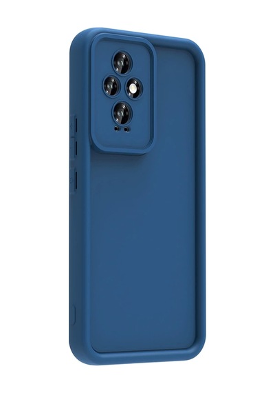 Honor 200 Kılıf Kamera Korumalı Zore Ananas Kapak