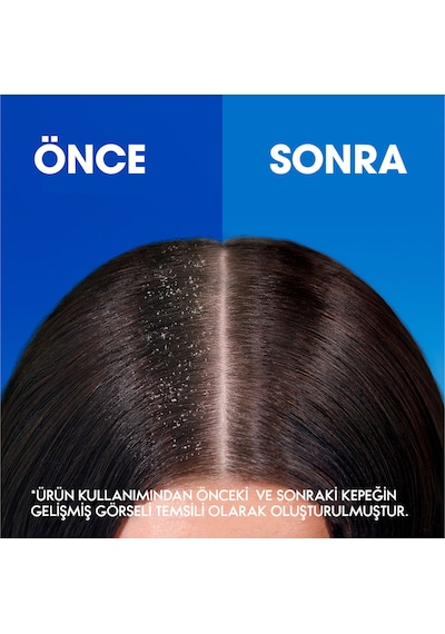 Head & Shoulders Mentol Ferahlığı Kepeğe Karşı Etkili Şampuan 750 ML
