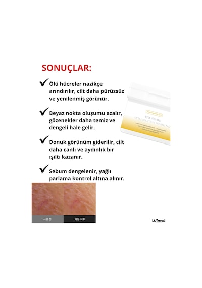 Apothe Exosome Anti-pollution Toning Pad 170 Ml Ekzozomal Gözenek Arındırıcı Aydınlatıcı Pedler
